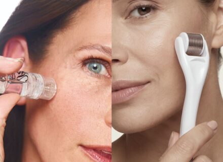 Micro-infusione e microneedling: quali sono le differenze?