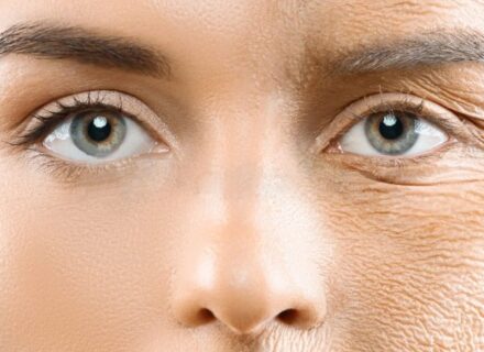 Microneedling e collagene: cosa succede realmente nella pelle