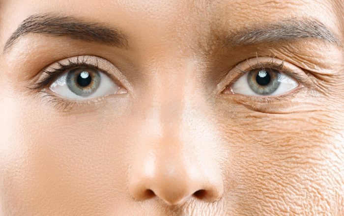 Microneedling e collagene: cosa succede realmente nella pelle
